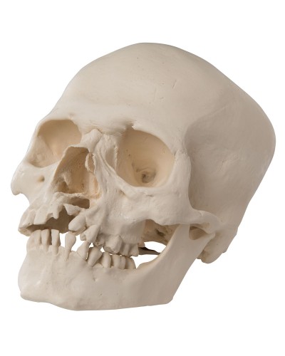 Human Skull Model with Cleft Jaw and Palate